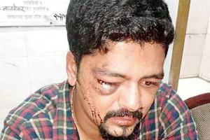 TV journalist assaulted near his home in Gamdevi