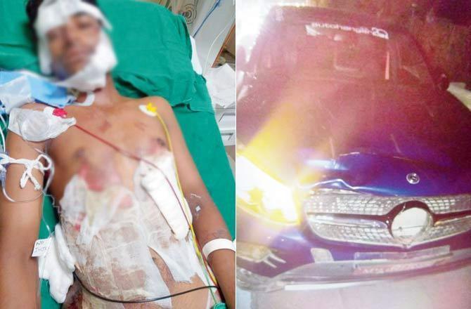 Mumbai Crime: Brat knocks down sea link staffer, blames his driver