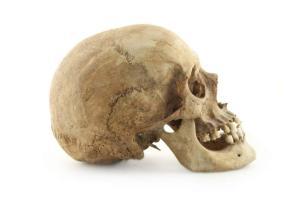 Four-year-old girl gets skull implant in Pune