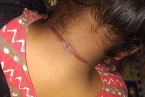 Mumbai Crime: 20-year-old girl accuses corporator of molestation