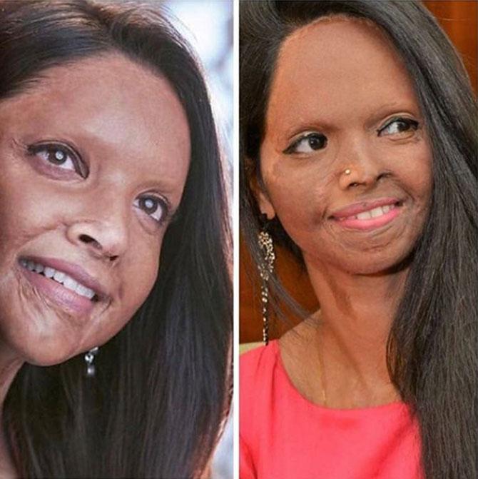 Laxmi Agarwal's life as an acid attack survivor has inspired an upcoming Bollywood film 'Chhapaak'. Deepika Padukone will be essaying the role of an acid attack survivor whose character 'Malti' is based on Laxmi Agarwal. The actress believes the story needs to be told and has bankrolled her maiden production along with KA Productions to put forth a strong, brave, courageous and independent female character
In picture: Deepika Padukone's look from 'Chhapaak' and Laxmi Agarwal