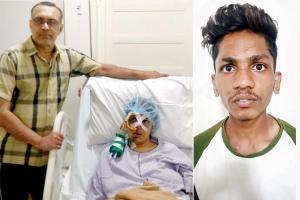 Mumbai: Heart patient has jaw break, brow crack as biker speeds on