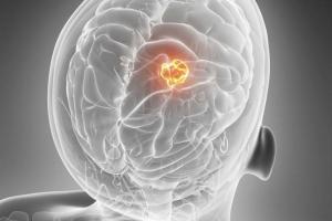 Obesity can break down protective blood brain barrier, trigger memory