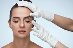 What is an eyelid crease and what can you do about it