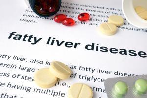 Importance of regular check-up for fatty liver