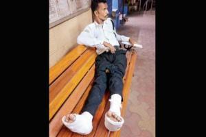 Mumbai: Car driving up wrong way breaks warden's legs, cops abandon him