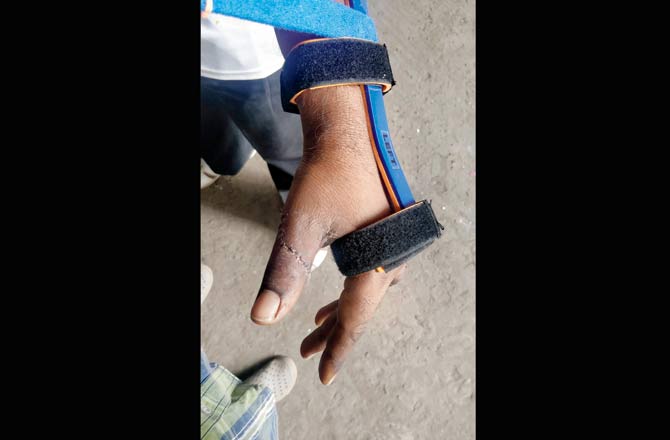 The robber had slashed Shaikh