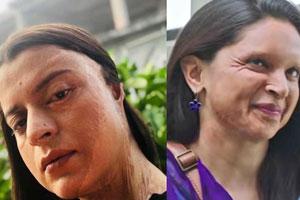 Kangna Ranaut's sister Rangoli reacts to Deepika's Chhapaak trailer