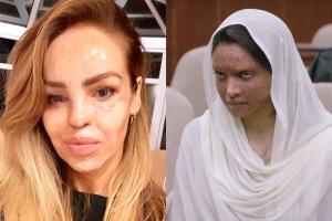 Katie Piper is blown away by the trailer of Deepika Padukone's Chhapaak