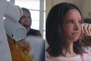 Deepika in Chhapaak as acid-attack survivor will leave you speechless