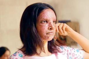 Meghna Gulzar on Chhapaak: Found our Malti in first prosthetics session