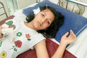 Mumbai: 12-year-old walks into hospital with rusted nail stuck in head