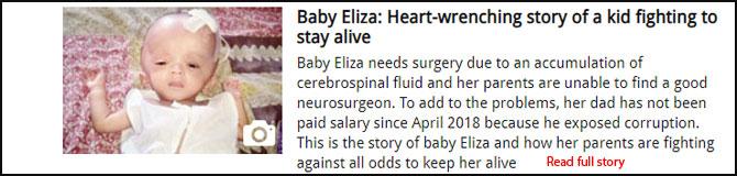 Baby Eliza: Heart-wrenching story of a kid fighting to stay alive
