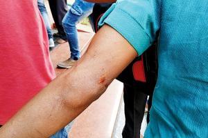 Deaf-mute protesters fighting for basic rights lathi-charged by police