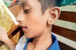 Mumbai: Man approaches cops to know who 'pinched' his son in school