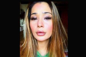 What has Bidaai actress Sara Khan done to her face?