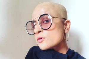 Tahira Kashyap shares a bold bald image post cancer diagnosis 