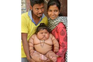 8-month-old girl weighs 17 kg and doctors don't know why