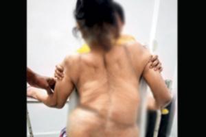 Byculla railway hospital creates a hole new record with 56-yr-old