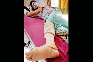 BMC offers Rs 50K to man after a tree being cut crushes his right leg