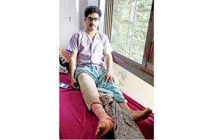 Mumbai: Tree cut by BMC breaks biker's leg in Sion