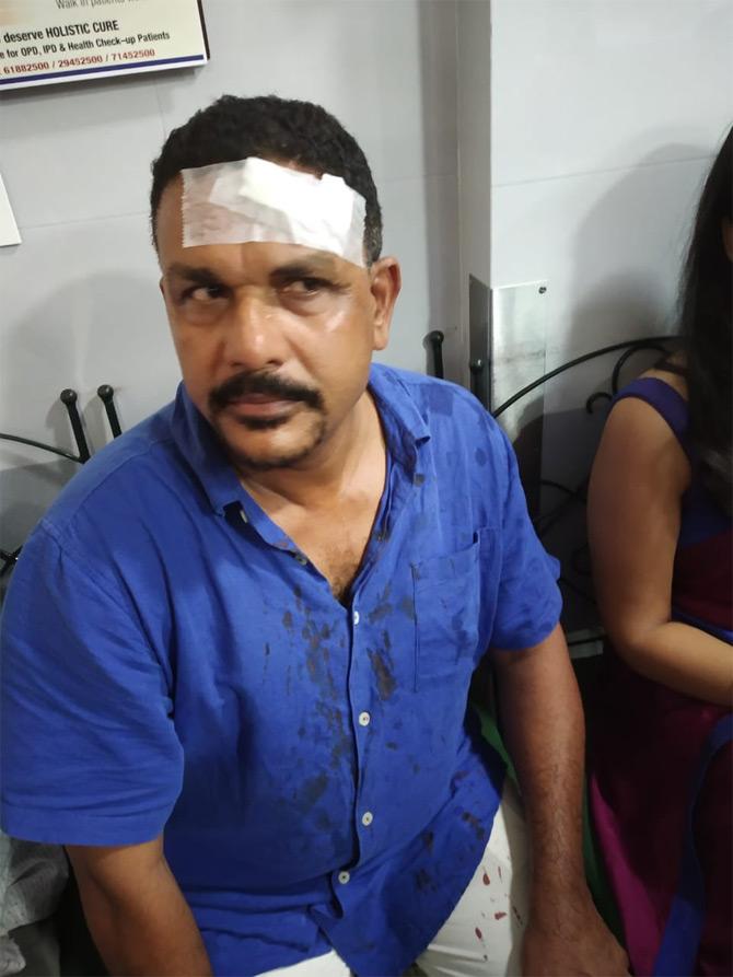 Actor injured A