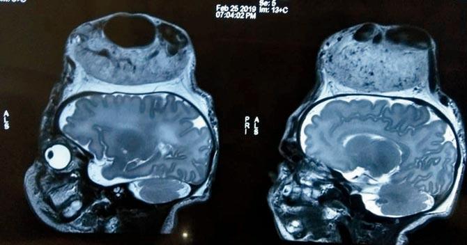 An MRI scan of the baby