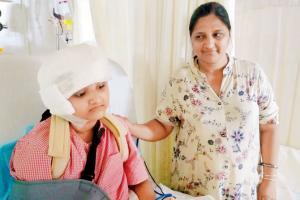 12-year-old's scalp ripped apart in carting accident in Mahabaleshwar