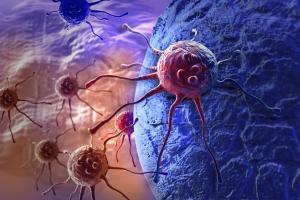 Researchers discover four hallmarks of cancer metastasis