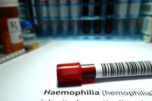 Haemophilia: Early diagnosis and intervention crucial