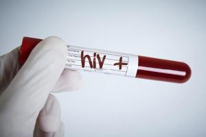 Data indicates HIV affects people more in 15-49 years age group
