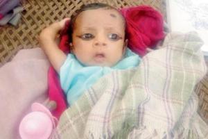 Baby Prince's chest infection spreading, say KEM hospital doctors