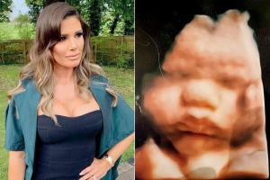 Rebekah Vardy posts picture of baby scan on social media