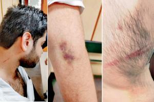 'Cops beat a colleague, molested women lawyers, lathicharged us'