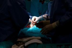 Facts about bypass surgery you need to know