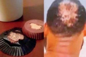 LeBron James feels his balding head resembles a ruined cup cake
