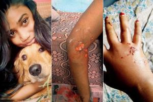 Mumbai: Stray dog bites Belapur woman thrice in four months