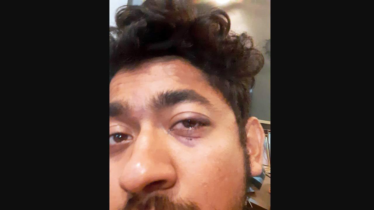 Vasai cops hit me for refusing Rs 25,000 bribe: Student