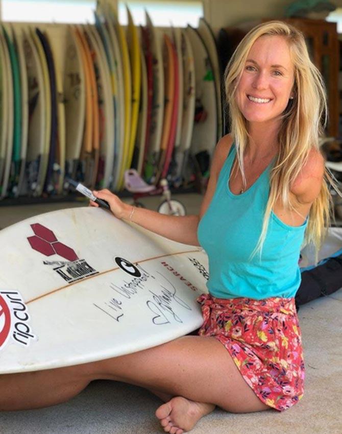 This Female Surfer Survived A Deadly Shark Attack And Has Just One Arm This Female Surfer Survived A Deadly Shark Attack And Has Just One Arm