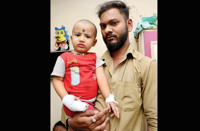 The toddler received 25 stitches on his right palm. Pics/Rajesh Gupta