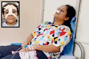 Woman slapped by unknown man at Mulund station; suffers broken nose