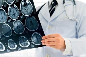 Mumbai: Stroke support groups to counter rising mortality rate