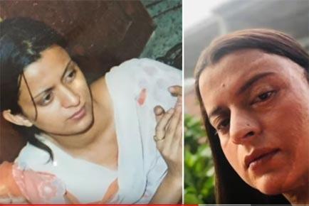 Acid attack victim Rangoli Chandel reveals name of her attacker