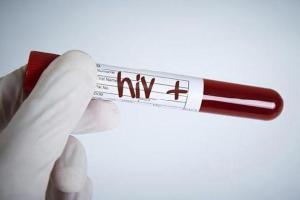 Man does not inform wife about HIV before marriage, infects her; booked
