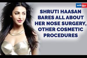 Shruti Haasan unapologetically bares all about her nose surgery