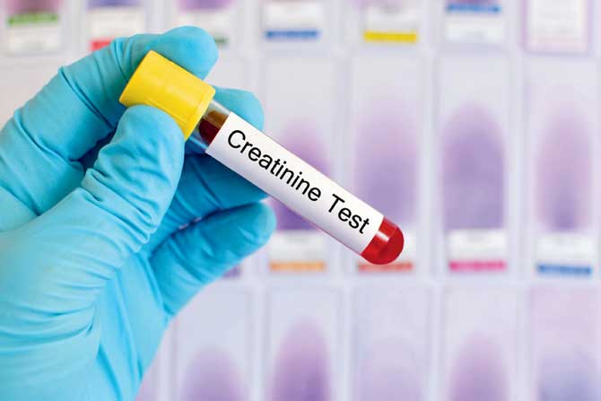 On their family doctor’s advice, a second round of blood tests at Soorya hospital revealed that his creatinine level was normal at 0.8. PIC/ISTOCK