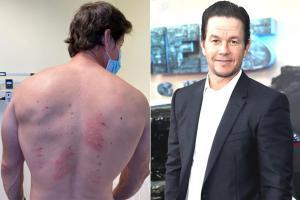 Mark Wahlberg: I am almost allergic to everything