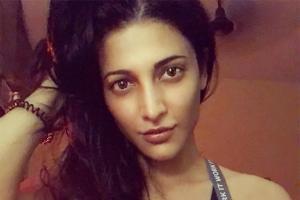 Shruti: I didn't like the way my nose looked, it was a personal choice