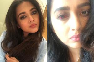 Khatron Ke Khiladi: Tejasswi Prakash shares photos of her eye injury