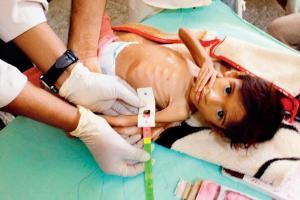 2.4 million Yemeni children may starve in 6 months due to COVID-19